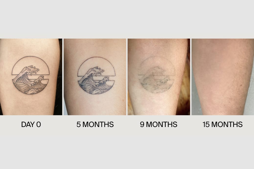 How Ephemeral Tattoo's Semi-Permanent Ink Works